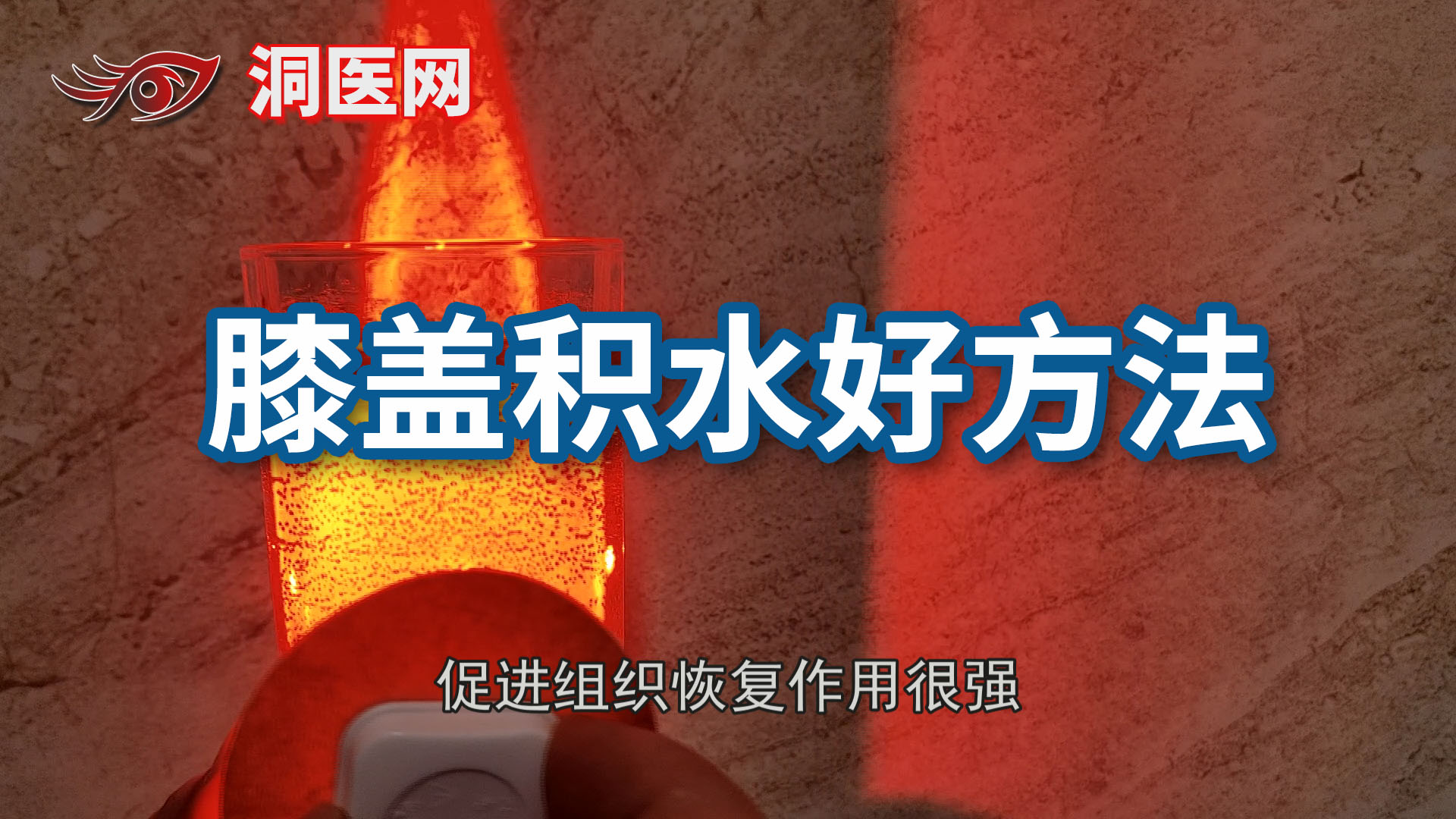 肩袖损伤如何恢复_议美网