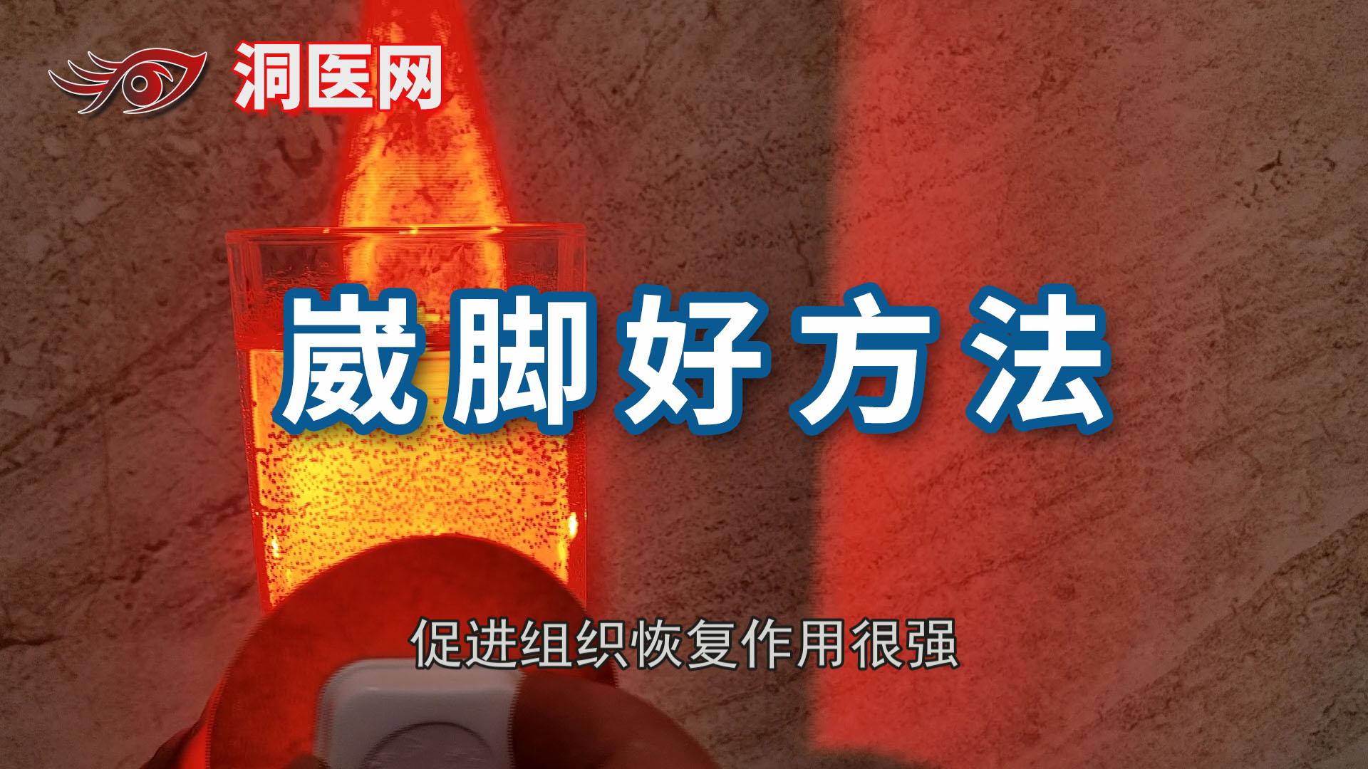 脚崴了几天能正常走路_议美网