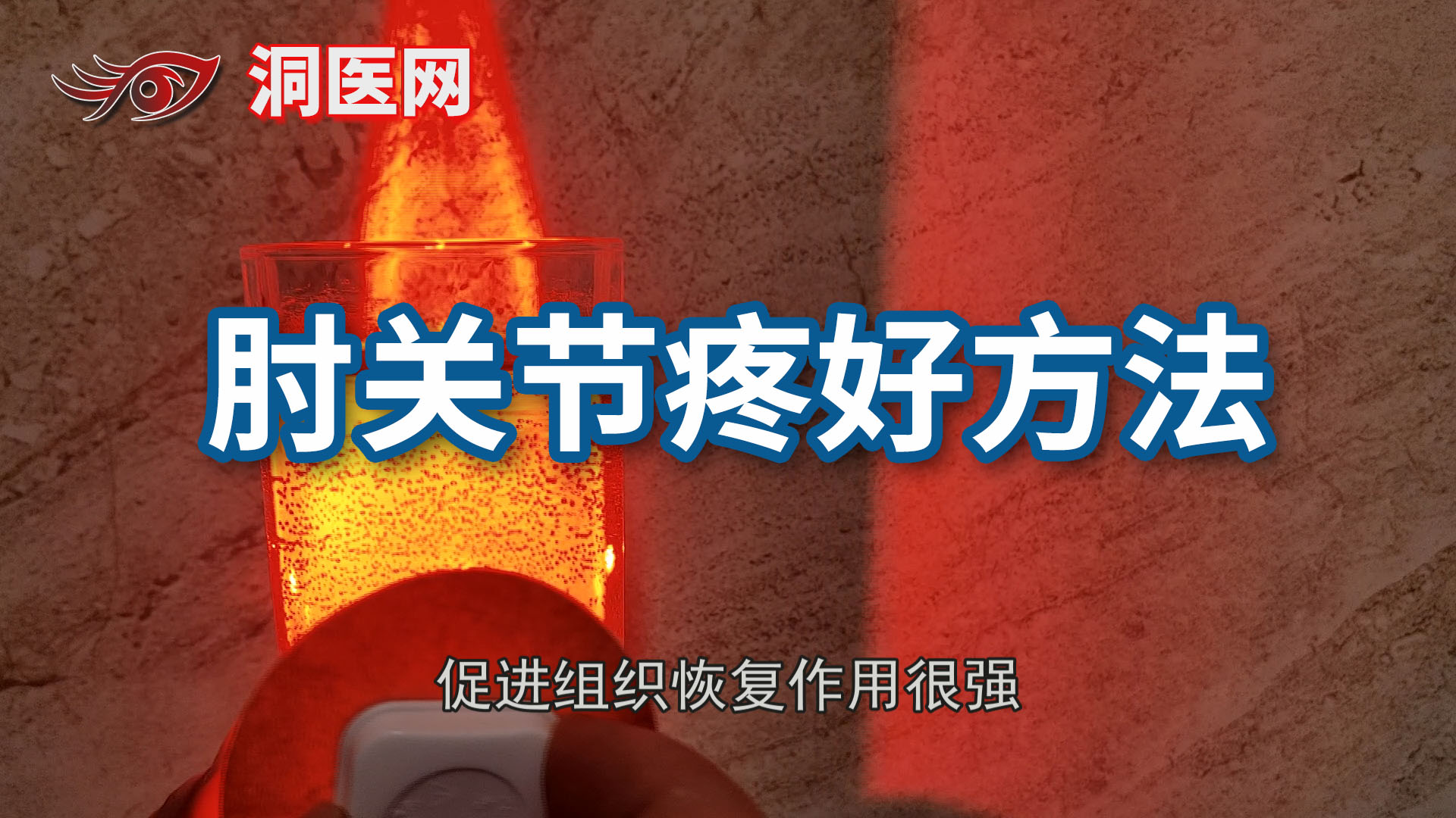 网球肘最严重后果_议美网