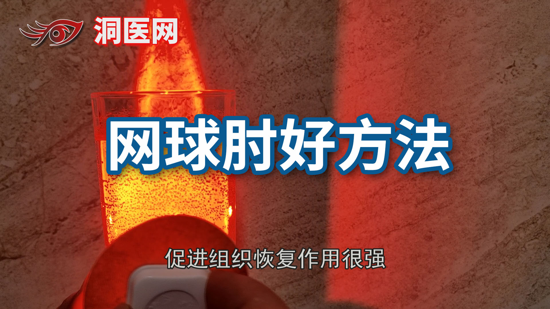 网球肘最严重后果_议美网